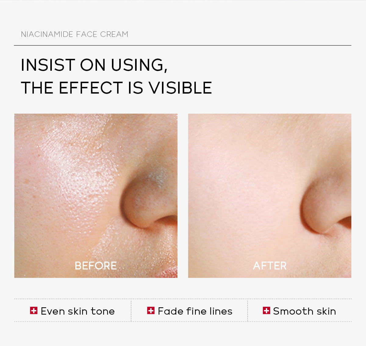 Laikou Niacinamide Whitening Cream Oil Control Oil Control Anti-wrinkle Moisturizing Facial Cream Korean Skin Care Cosmetics 30g