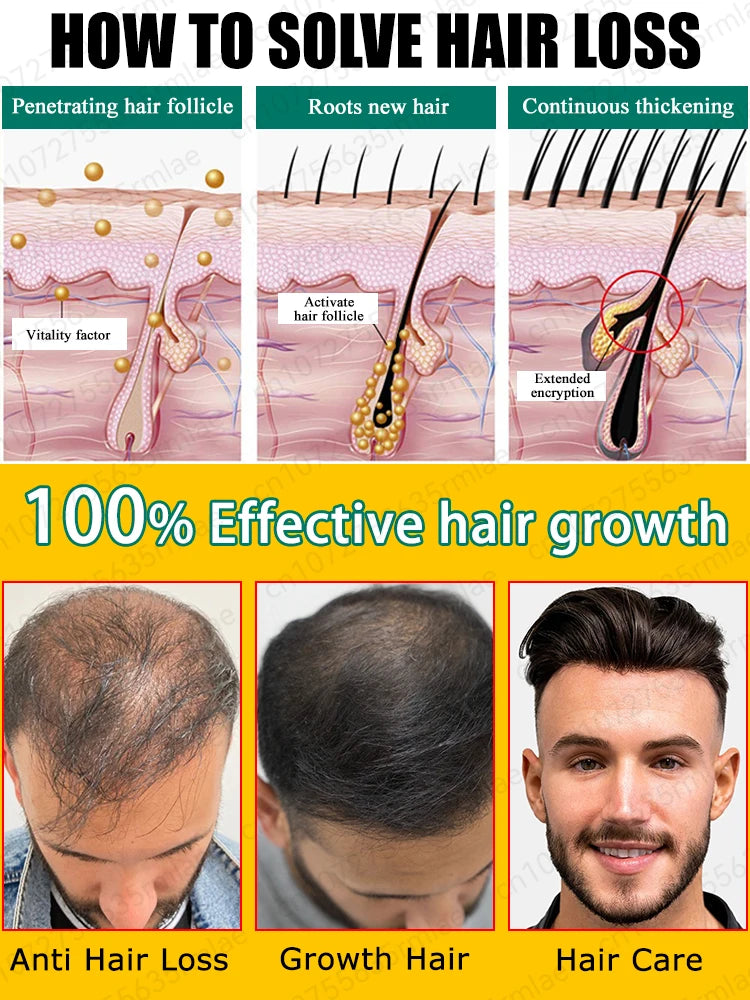 Huile essentielle de croissance rapide des cheveux, répare la calvitie