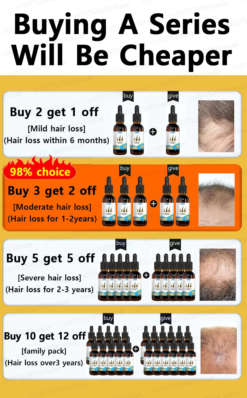 Huile essentielle de croissance rapide des cheveux, répare la calvitie