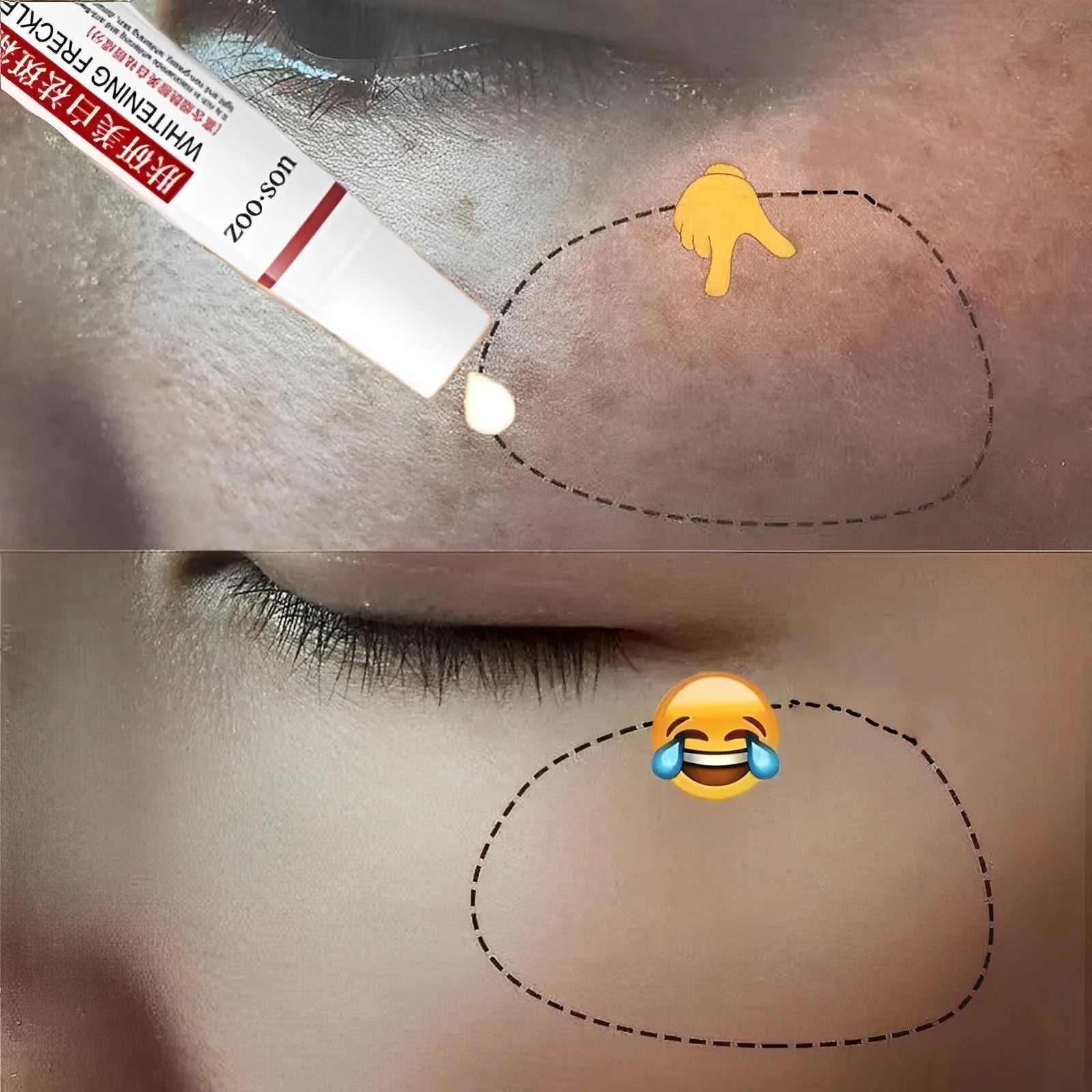 Powerful Spot-removing Whiten Cream Brighten Skin Fast Eliminates Melanin Pigmentation Melasma Dark Spots Moisturize Beauty Gel