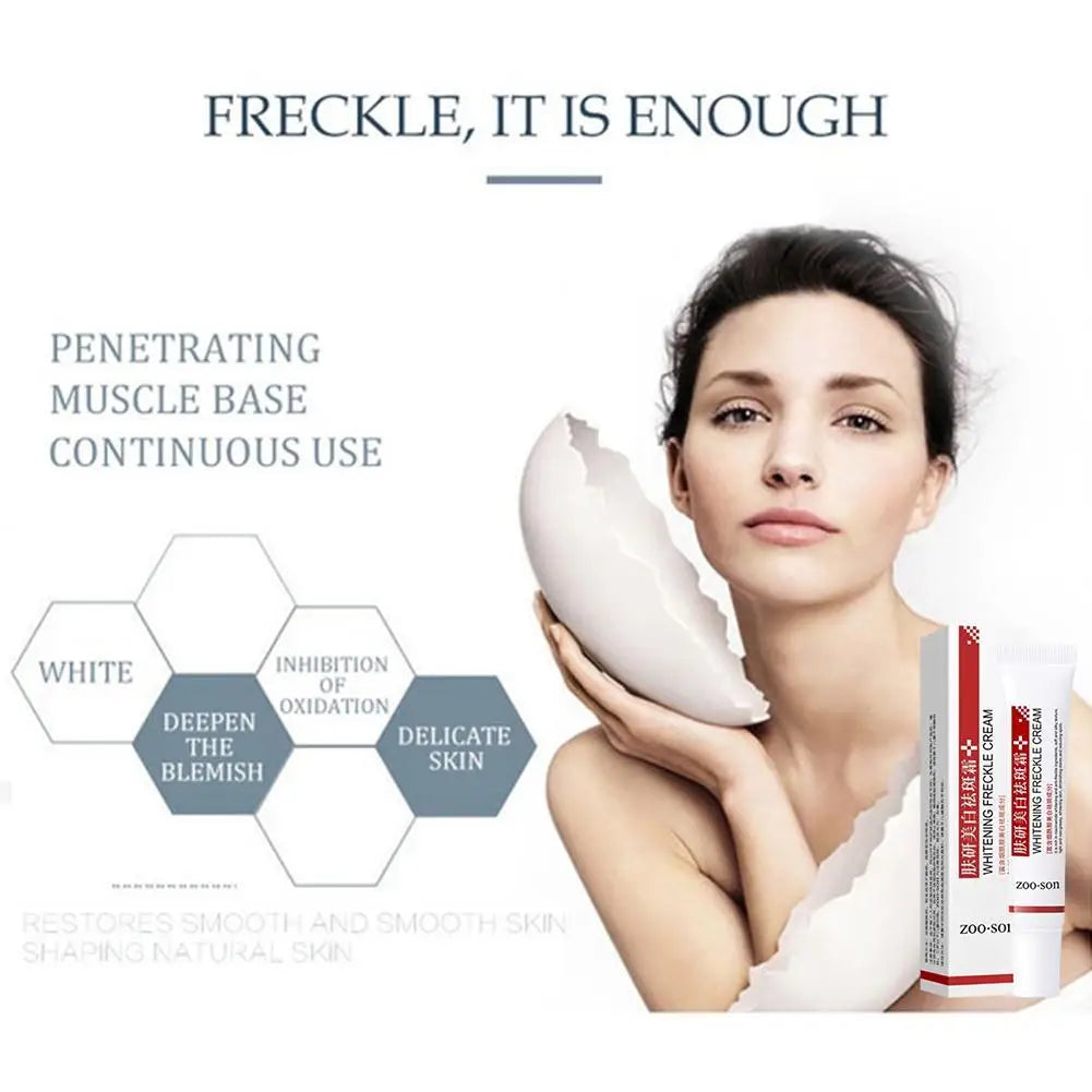 Powerful Spot-removing Whiten Cream Brighten Skin Fast Eliminates Melanin Pigmentation Melasma Dark Spots Moisturize Beauty Gel