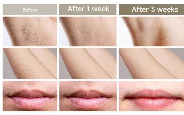 IPL Laser Epilator for Women Hair Trimmer Man Shaver Remover Mower Men's Electric Shaver Bikinis Razor GYM Hair Cutting Machine