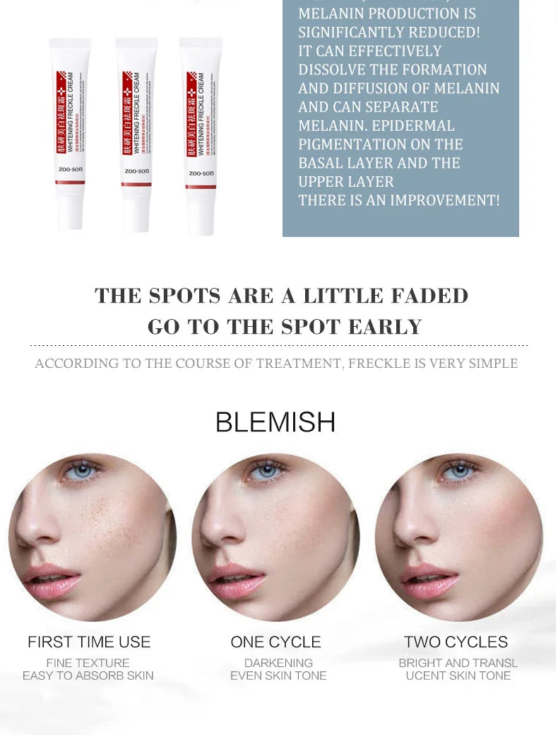 Powerful Spot-removing Whiten Cream Brighten Skin Fast Eliminates Melanin Pigmentation Melasma Dark Spots Moisturize Beauty Gel