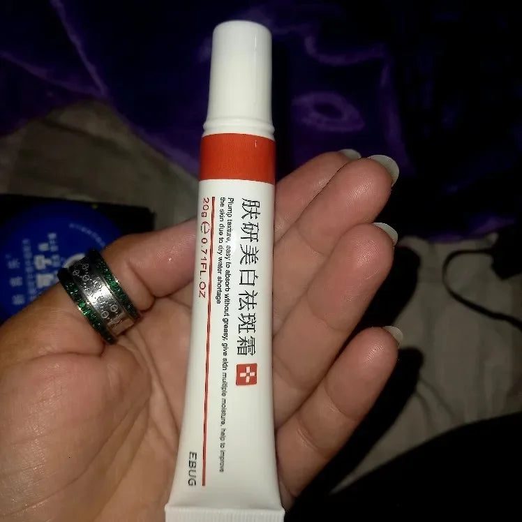 Powerful Spot-removing Whiten Cream Brighten Skin Fast Eliminates Melanin Pigmentation Melasma Dark Spots Moisturize Beauty Gel