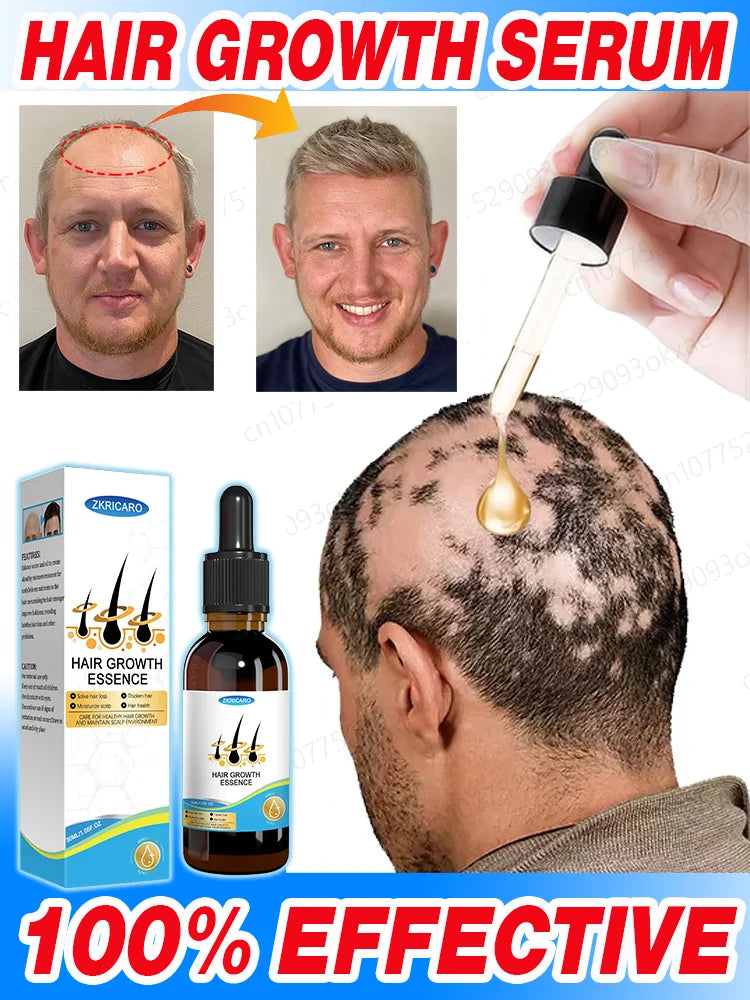 Huile essentielle de croissance rapide des cheveux, répare la calvitie
